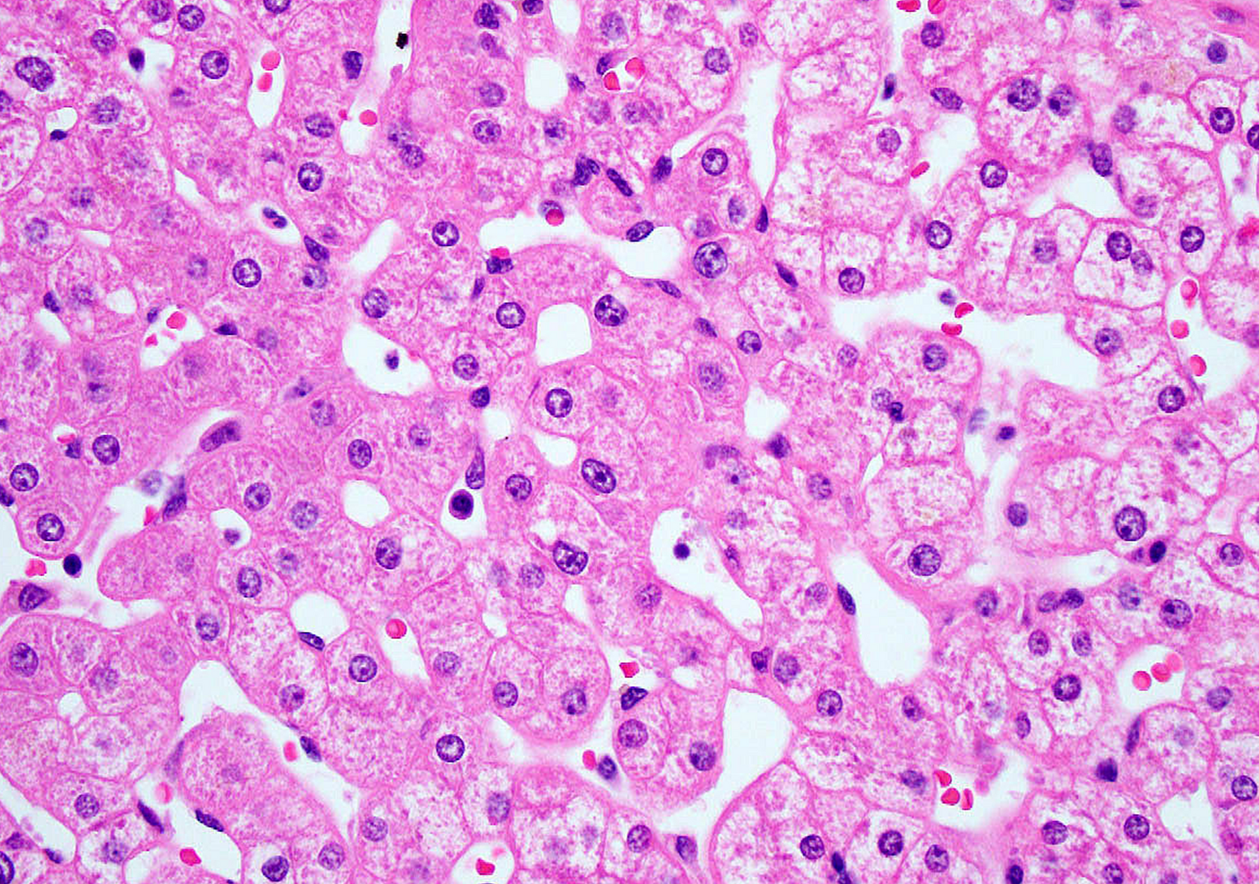 The Liver Meeting (TLM) 2026